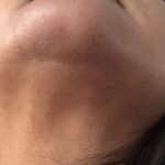 IceZen Air+ Painless IPL Hair Removal Device photo review