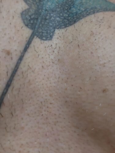 Click to view full screen IceZen Air+ Painless IPL Hair Removal Device photo review