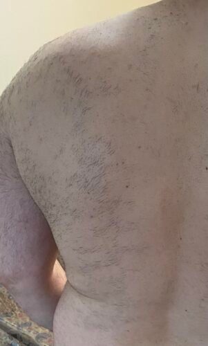 Click to view full screen IceZen Air+ Painless IPL Hair Removal Device photo review