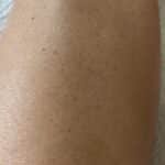 IceZen Air+ Painless IPL Hair Removal Device photo review