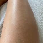 IceZen Air+ Painless IPL Hair Removal Device photo review